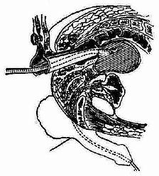 ��Ƥ��ܷ���ŧǻ�ڣ��Ӹ�������